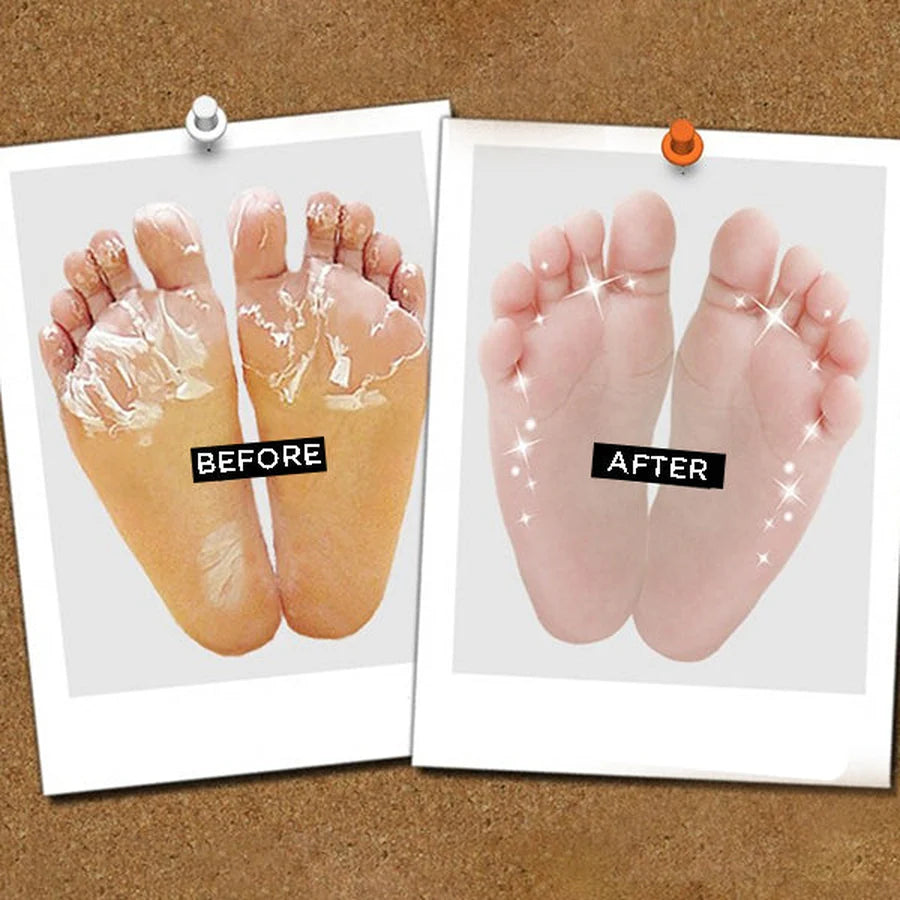 Double & Zero Double Effect Foot Peeling Mask