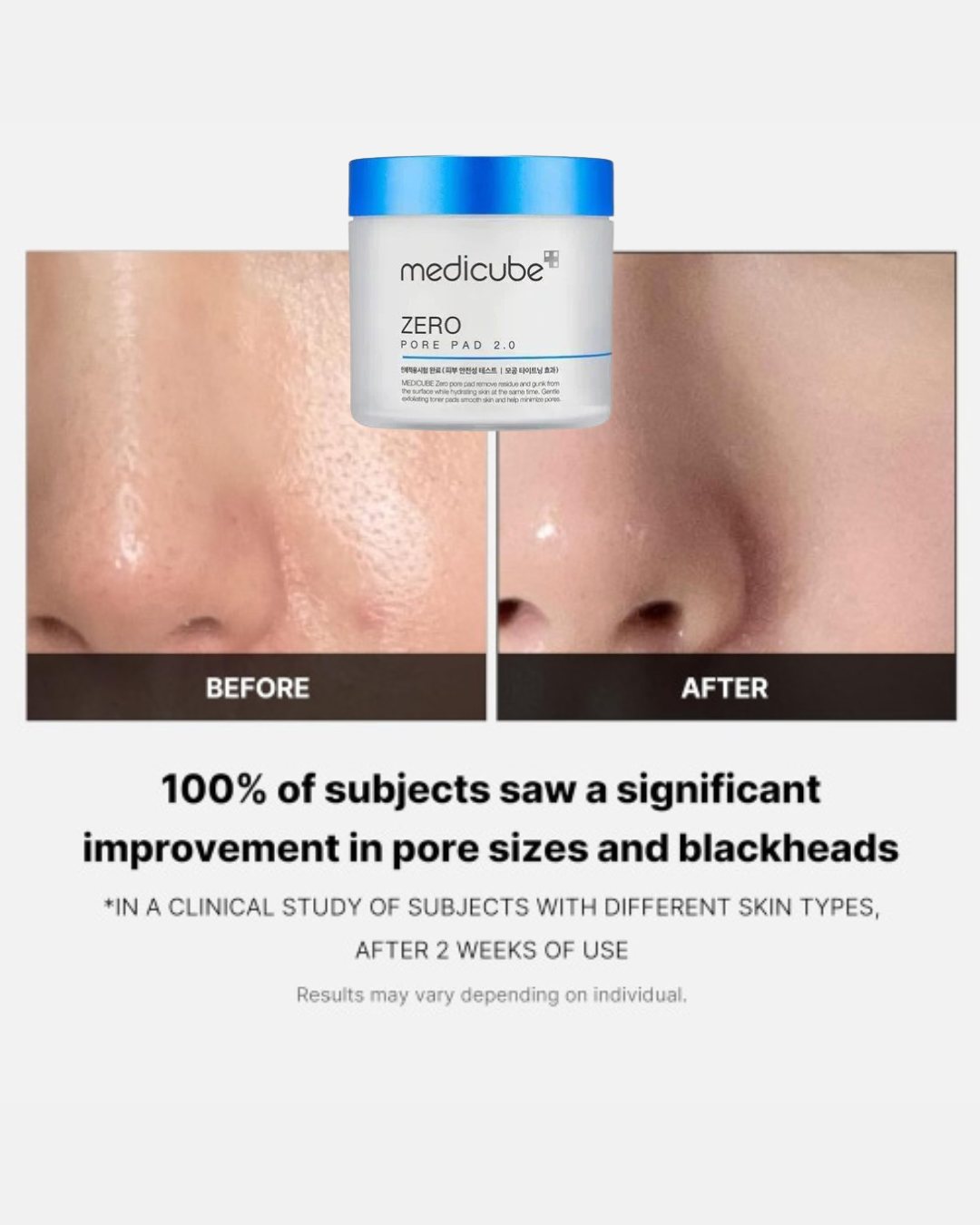 Medicube Zero Pore Pad 2.0