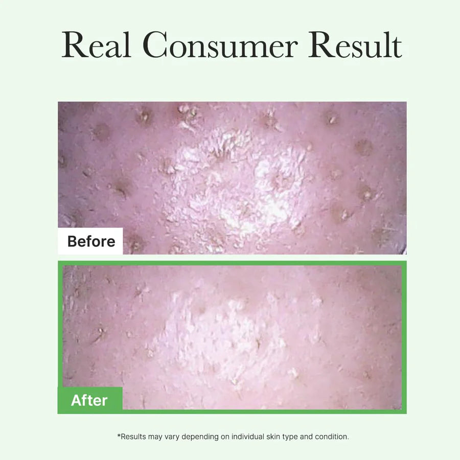 Arencia Pore Melt Mochi Cleansing Oil  200ml