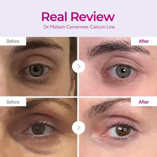 Dr. Melaxin Cemenrete Calcium Volume Cream 50g