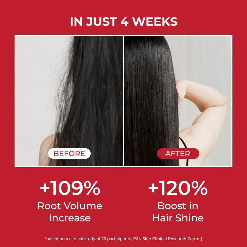 MOEV Annurcatin Shampoo [300ml]