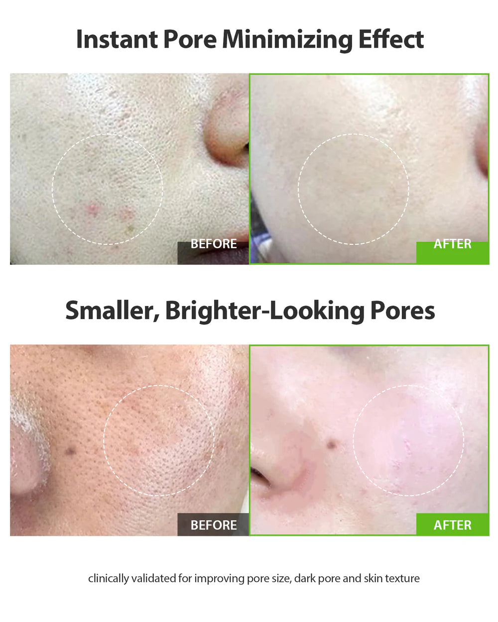 Sungboon Editor Green Tomato Pore Lifting Ampoule 40ml